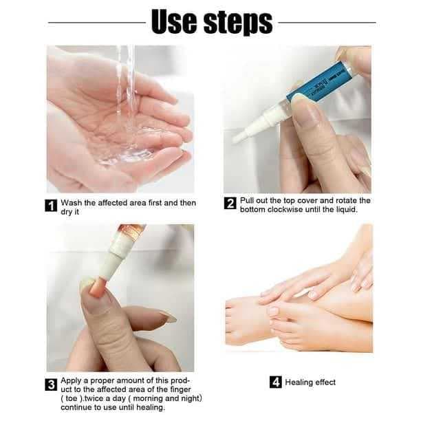 Gel de uñas fungicida de 3ml 2