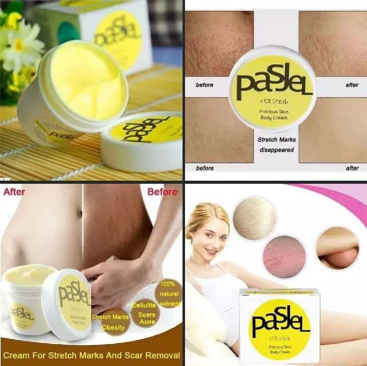 crema anti estrias
