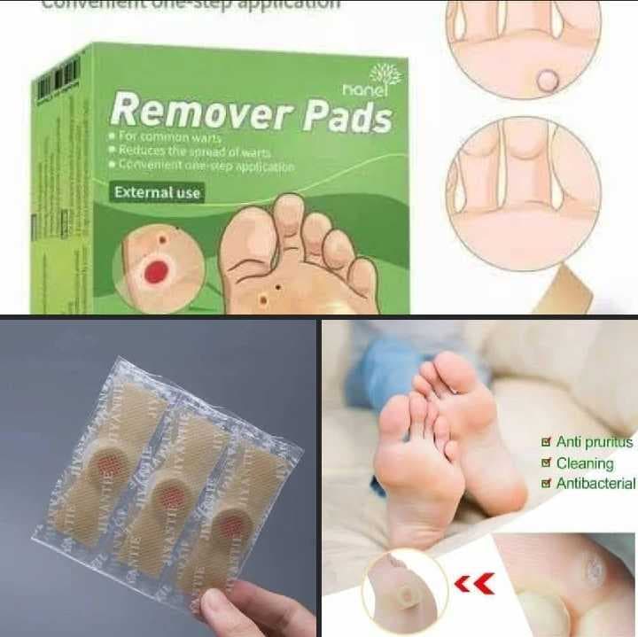 parche removedor de callos